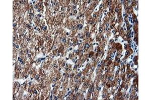 Immunohistochemical staining of paraffin-embedded liver tissue using anti-FAHD2Amouse monoclonal antibody. (FAHD2A 抗体)
