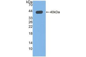 Western blot analysis of recombinant Human QPCT. (QPCT 抗体  (AA 29-361))