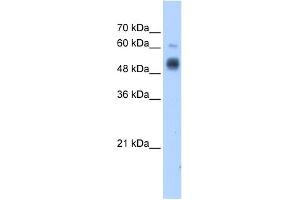 Western Blotting (WB) image for anti-Glucosaminyl (N-Acetyl) Transferase 3, Mucin Type (GCNT3) (C-Term) antibody (ABIN2781304)