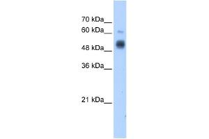 WB Suggested Anti-GCNT3 Antibody Titration:  1. (GCNT3 抗体  (C-Term))