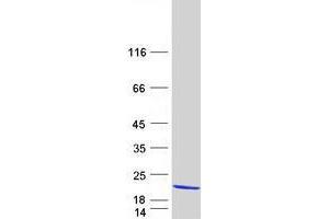 Validation with Western Blot (TMEM80 Protein (Transcript Variant 1) (Myc-DYKDDDDK Tag))
