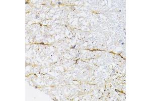 Immunohistochemistry (Paraffin-embedded Sections) (IHC (p)) image for anti-Kinesin Family Member 1B (KIF1B) (AA 1501-1770) antibody (ABIN6142861)