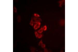 Immunofluorescent analysis of Connexin 40 staining in HepG2 cells. (Cx40/GJA5 抗体)