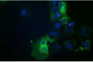 Anti-HDAC6 mouse monoclonal antibody (ABIN2454079) immunofluorescent staining of COS7 cells transiently transfected by pCMV6-ENTRY HDAC6 (RC209649). (HDAC6 抗体)