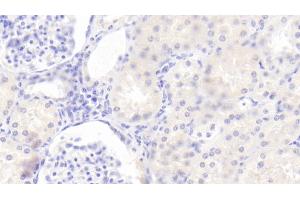 Detection of TSLP in Human Kidney Tissue using Polyclonal Antibody to Thymic Stromal Lymphopoietin (TSLP) (Thymic Stromal Lymphopoietin 抗体  (AA 29-159))