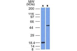 Western blot testing of A) partial recombinant protein B) A375 cell lysate using SOX10 antibody (SOX10/991). (SOX10 抗体  (AA 115-269))
