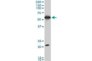 EBF3 monoclonal antibody (M06), clone 1G3. (EBF3 抗体  (AA 381-480))