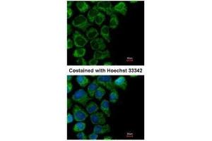 ICC/IF Image Immunofluorescence analysis of methanol-fixed A431, using OAT, antibody at 1:200 dilution. (OAT 抗体)