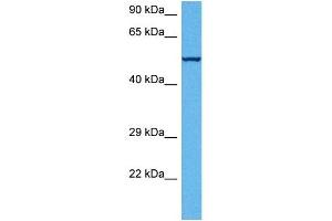 Western Blotting (WB) image for anti-ATP Synthase, H+ Transporting, Mitochondrial F1 Complex, beta Polypeptide (ATP5B) (C-Term) antibody (ABIN2783269)