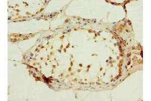 Immunohistochemistry of paraffin-embedded human testis tissue using ABIN7174888 at dilution of 1:100 (C7orf61 抗体  (AA 1-206))