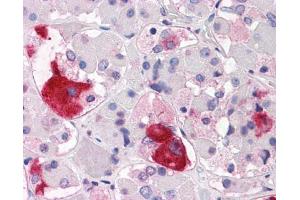 Immunohistochemistry (IHC) image for anti-Corticotropin Releasing Hormone Receptor 2 (CRHR2) (N-Term) antibody (ABIN1048464)