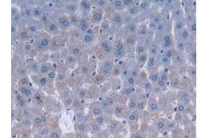 Immunohistochemistry (IHC) image for anti-Slit Homolog 3 (SLIT3) (AA 1348-1517) antibody (ABIN7438367)