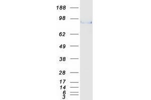 Western Blotting (WB) image for SRY (Sex Determining Region Y)-Box 6 (SOX6) (Transcript Variant 2) protein (Myc-DYKDDDDK Tag) (ABIN2732469)