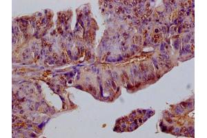 Immunohistochemistry of paraffin-embedded human adrenal gland tissue using ABIN7152940 at dilution of 1:100 (FIL1L 抗体  (AA 1-200))