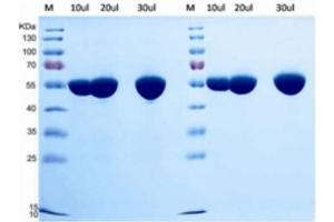 Human Serum Albumin (HSA) protein