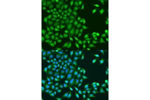 Immunofluorescence analysis of U2OS cells using RUVBL1/TIP49A/PONTIN antibody (ABIN6132606, ABIN6147318, ABIN6147320 and ABIN6218477) at dilution of 1:100. (RUVBL1 抗体  (AA 1-214))