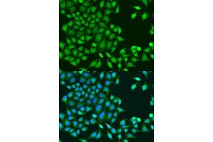 Immunofluorescence analysis of U2OS cells using RUVBL1/TIP49A/PONTIN antibody (ABIN6132606, ABIN6147318, ABIN6147320 and ABIN6218477) at dilution of 1:100. (RUVBL1 抗体  (AA 1-214))