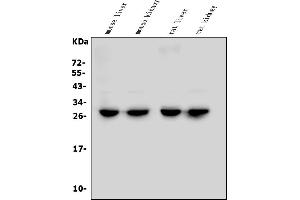 Western blot analysis of L/CMBL using anti-L/CMBL antibody (ABIN7602830).
