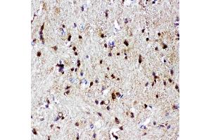 Anti-p73 antibody, (ABIN3043469), IHC(P)IHC(P): Rat Brain Tissue (Tumor Protein p73 抗体  (AA 1-198))