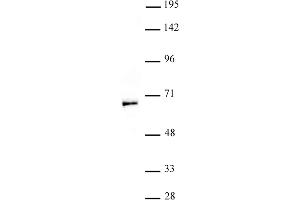 MOF / MYST1 antibody (pAb) tested by Western blot. (MYST1 抗体  (N-Term))