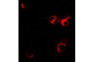 Immunofluorescent analysis of IL-1RA staining in MCF7 cells. (IL1RN 抗体)