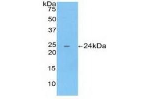 Detection of Recombinant CTSB, Human using Polyclonal Antibody to Cathepsin B (CTSB) (Cathepsin B 抗体  (AA 129-333))