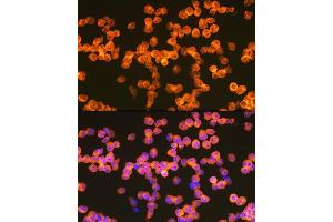 Immunofluorescence analysis of Jurkat cells using Z Rabbit mAb (ABIN7271430) at dilution of 1:100 (40x lens). (ZAP70 抗体)
