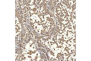 IHC analysis of TST using anti-TST antibody (ABIN7599105). (TST 抗体  (AA 1-220))