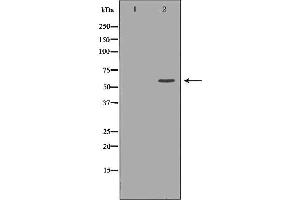 Western blot analysis of Hela whole cell lysates, using MUTYH Antibody. (MUTYH 抗体  (Internal Region))