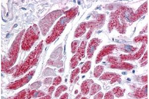 Human Heart: Formalin-Fixed, Paraffin-Embedded (FFPE) (IDH2 抗体  (AA 354-452))