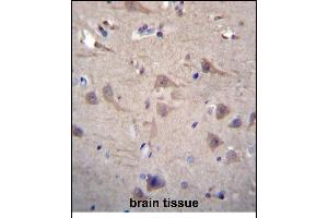 Immunohistochemistry (Paraffin-embedded Sections) (IHC (p)) image for anti-Chaperonin Containing TCP1, Subunit 8 (Theta) (CCT8) (AA 519-548), (C-Term) antibody (ABIN656431)