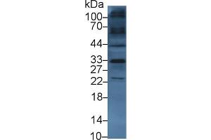 Western blot analysis of Mouse Heart lysate, using Human TKA1 Antibody (3 µg/ml) and HRP-conjugated Goat Anti-Rabbit antibody ( (SLC9A3R2 抗体  (AA 56-326))