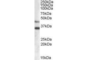 Image no. 1 for anti-Arylsulfatase B (ARSB) (Internal Region) antibody (ABIN374887) (Arylsulfatase B 抗体  (Internal Region))