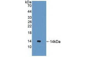 Detection of Recombinant UBQLN2, Human using Polyclonal Antibody to Ubiquilin 2 (UBQLN2) (Ubiquilin 2 抗体  (AA 33-126))