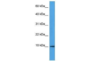 Western Blot showing DEFB4A antibody used at a concentration of 1-2 ug/ml to detect its target protein. (DEFB4A 抗体  (N-Term))