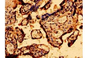 Immunohistochemistry of paraffin-embedded human placenta tissue using ABIN7146314 at dilution of 1:100 (MCU 抗体  (AA 155-233))