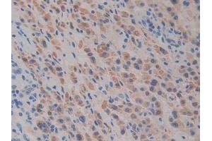 Detection of Slit1 in Human Liver Tissue using Polyclonal Antibody to Slit Homolog 1 (Slit1)