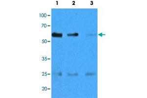 Western blot analysis of mouse muscle extracts (35 ug) with CASQ2 monoclonal antibody, clone AT4E10  at 1:500 (Lane 1), 1:1000 (Lane 2) and , 1:5000 (Lane 3) dilution. (CASQ2 抗体  (AA 20-399))