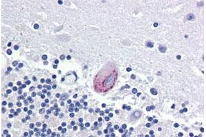 Immunohistochemical staining of human brain, cerebellum with LPCAT1 polyclonal antibody . (LPCAT1 抗体  (Internal Region))