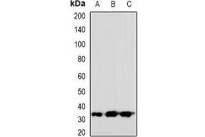 Western blot analysis of VGLL2 expression in HeLa (A), mouse heart (B), rat heart (C) whole cell lysates. (VGLL2 抗体)