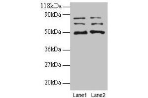 Western blot All lanes: VOPP1 antibody at 2 μg/mL Lane 1: EC109 whole cell lysate Lane 2: 293T whole cell lysate Secondary Goat polyclonal to rabbit IgG at 1/15000 dilution Predicted band size: 20, 19, 18 kDa Observed band size: 50, 70, 80 kDa (VOPP1 抗体  (AA 23-172))