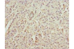 IHC analysis of paraffin-embedded human pancreatic tissue using ZFYVE1 antibody (1/100 dilution). (ZFYVE1 抗体  (AA 1-280))
