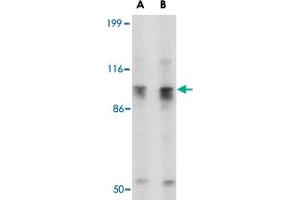 Western blot analysis of SLITRK6 in SK-N-SH cell lysate with SLITRK6 polyclonal antibody  at (A) 0. (SLITRK6 抗体  (C-Term))