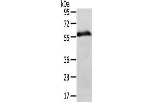 Gel: 8 % SDS-PAGE,Lysate: 40 μg,Lane: Human normal stomach tissue,Primary antibody: ABIN7192491(SLC43A2 Antibody) at dilution 1/200 dilution,Secondary antibody: Goat anti rabbit IgG at 1/8000 dilution,Exposure time: 5 minute