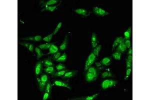 Immunofluorescent analysis of Hela cells using ABIN7155629 at dilution of 1:100 and Alexa Fluor 488-congugated AffiniPure Goat Anti-Rabbit IgG(H+L) (BBX 抗体  (AA 62-292))