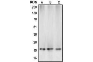 Western blot analysis of Caspase 5 p20 expression in MCF7 (A), mouse kidney (B), rat liver (C) whole cell lysates. (Caspase 5 p20 抗体  (Center))