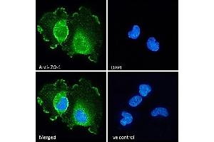 (ABIN570961) Immunofluorescence analysis of paraformaldehyde fixed U251 cells, permeabilized with 0. (TJP1 抗体  (Internal Region))