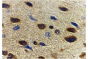 Immunohistochemistry (IHC) image for anti-Adiponectin (ADIPOQ) (C-Term) antibody (ABIN1030223) (ADIPOQ 抗体  (C-Term))
