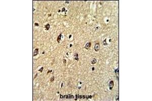 Formalin-fixed and paraffin-embedded human brain tissue with ABCC5 Antibody (Center), which was peroxidase-conjugated to the secondary antibody, followed by DAB staining. (ABCC5 抗体  (AA 625-652))