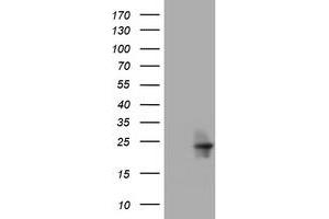 Image no. 1 for anti-Visinin-Like 1 (VSNL1) (AA 2-191) antibody (ABIN1491135) (VSNL1 抗体  (AA 2-191))